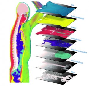 IT로 노인질환 ‘예측·진단’ 해법 찾았다